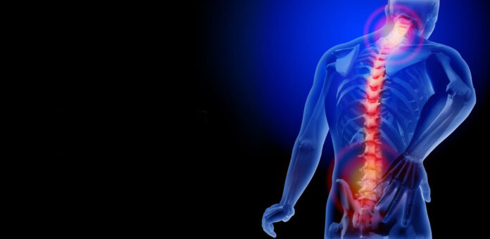 Ankylosing-Spondylitis